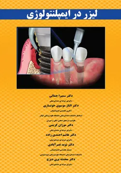 لیزر در ایمپلنتولوژی