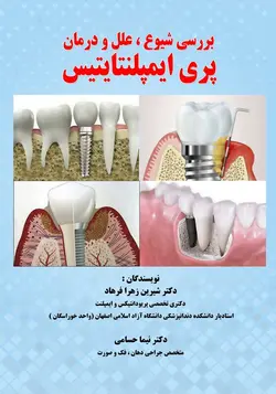 بررسی شیوع علل و درمان پری ایمپلنتایتیس
