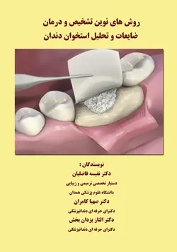 روشهای نوین تشخیص و درمان ضایعات و تحلیل استخوان دندان