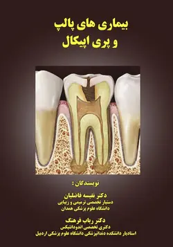 بیماریهای پالپ و پری اپیکال