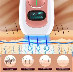 دستگاه لیزر اصلاح موهای بدن Aminzer - IPL Hair Removal Device PA2