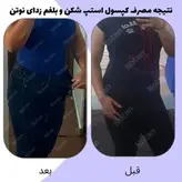 مکمل لاغری استپ شکن و کاهنده سایز نوتَن محصولی عالی وتضمینی