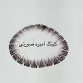مژه کینگ آمبره