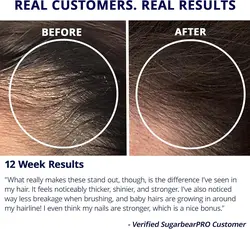 پاستیل تقویت مو شوگر بیرهیر پرو | Sugar Bear Hair Pro