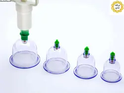 دستگاه بادکش بدن و حجامت طبی DYKL