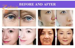 ماسک تونلی ال ای دی و کلسیم تراپی دویر مدل DEVOIR