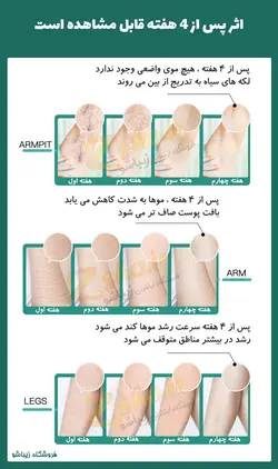 دستگاه لیزر سرد موهای زائد تاشو 999990 شات مدل 2021