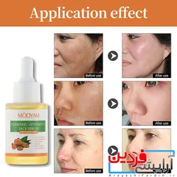 سرم ضد پیری زردچوبه مویام mooyam - آرایشی فردین