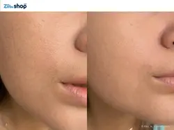 کرم صورت آبرسان ومرطوب کننده رنگی لاروش پوزایLa roche posa - فروشگاه اینترنتی زیبا شاپ