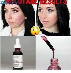 سرم درمانی پاکسازی پوست اوردینری The HYDRAIFE - فروشگاه اینترنتی زیبا شاپ