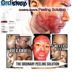 سرم درمانی پاکسازی پوست اوردینری The HYDRAIFE - فروشگاه اینترنتی زیبا شاپ