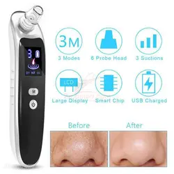 میکرو درم سه قدرته BLACK HEAD REMOVER
