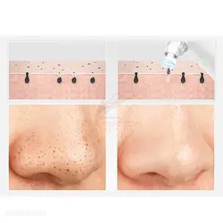 دستگاه میکرودرم آبی SH-8601 OF SKIN MANAGEMNT