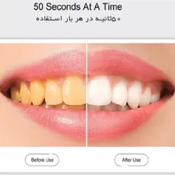 مسواک برقی التراسونیک سیلیکونی کارینا مدل GX-958