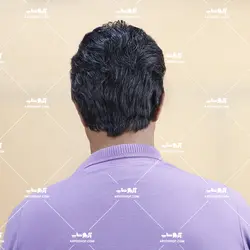 کلاه گیس مردانه جوگندمی با تراکم پایین