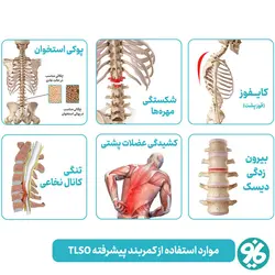 کمربند طبی اورتینو مدل TLSO Brace