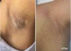 کوکتل واتنینیگ (روشن کننده) وولر ۱۱میل Whitening فرانسه