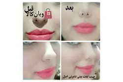 چسب لیفت بینی اورجینال 3M