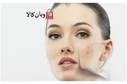 ماسک پودری آدامسی و لاتکسی عصاره نعنا برند Sun ساخت کره