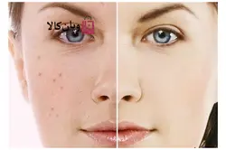 ماسک پودری آدامسی و لاتکسی عصاره بلوبری برند Sun ساخت کره