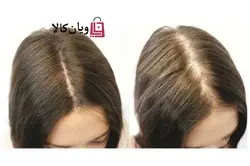 کوکتل ضد ریزش مو مزولایک MESOLIKE مدل +Hair