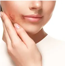 کرم مناسب پوست های آسیب دیده ژیناژن Ginagen