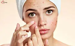 کیت زیبایی میله های 4 عددی کومدون Comedons