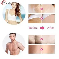 دستگاه لیزر خانگی صورت و بدن 1میلیون شات IPL