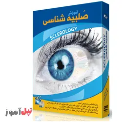 آموزش تصویری تشخیص بیماری از طریق صلبیه-استاد علی حسینی