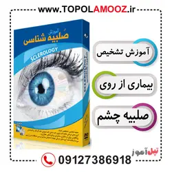 آموزش تصویری تشخیص بیماری از طریق صلبیه-استاد علی حسینی