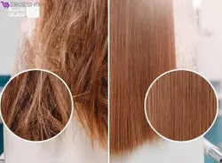 دستگاه نانو استیم (هیدروژن تراپی)