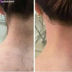 سرم موبر دائمی اپی سافت