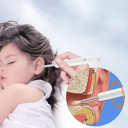 گوش پاک کن هوشمند کودک نورمس مدل NU30