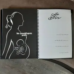 آلبوم نی نی نامه عکس و خاطرات نوزاد و کودک
