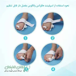اسپلینت هالوکس والگوس مفصل دار قابل تنظیم