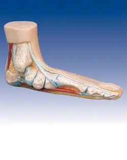 مدل (مولاژ) کف پای سالم و بیمار