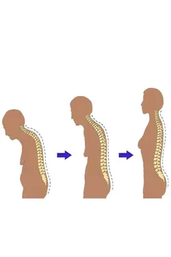 پشتیبان کوله پشتی ارتوپدیک حالت دور کمر پزشکی دوشی برند figiza کد 1648714595
