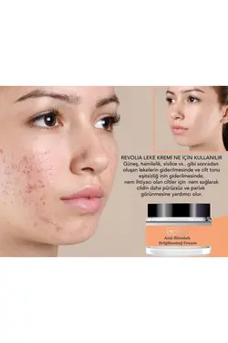 ویتامین کرم نرم‌کننده هایلایتر لکه تیره ضد برند REVOLIA کد 1651000567