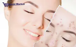 دستگاه لیزر آراف فرکشنال Fractional RF Fractional RF