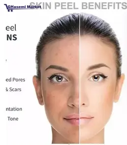 درمااف کره ای لابل نسل ۶ام labelle l6 لبل labelle sonic peel