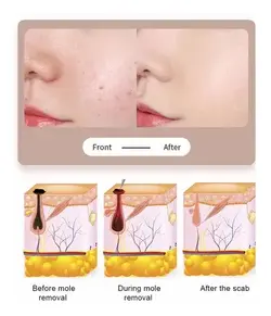 دستگاه بیوتی پن مدل ۹ قدرته لیزری