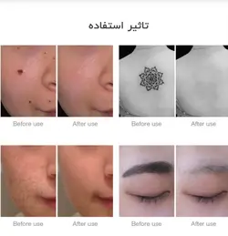 دستگاه نیت سل پاک کننده تتو و خال Neatcell