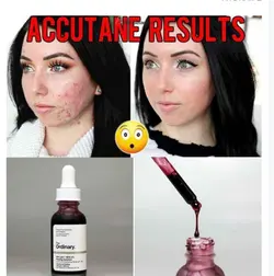 سرم درمانی پاکسازی پوست اوردینری The HYDRAIFE اصل کانادا هست - قاسمی مارکت