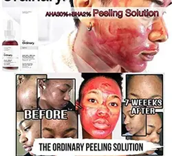 سرم درمانی پاکسازی پوست اوردینری The HYDRAIFE اصل کانادا هست - قاسمی مارکت