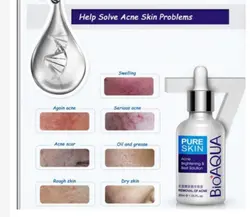 سرم درمانی و ترمیم کننده ضد جوش و آکنه صورت - قاسمی مارکت