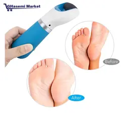 سوهان برقی وشارژی کف و پاشنه پا شُول