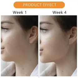 دستگاه فرم دهی صورت و زاویه فک jawline مدل FM بسته 3 عددی