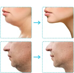 دستگاه فرم دهی صورت و زاویه فک jawline مدل FM بسته 3 عددی