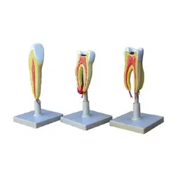 مولاژ 3 مرحله ای دندان