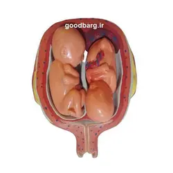 مولاژ 8 مرحله ای جنین